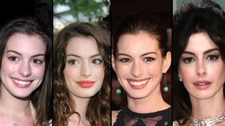 Anne Hathaway Plastic Surgery Before and After