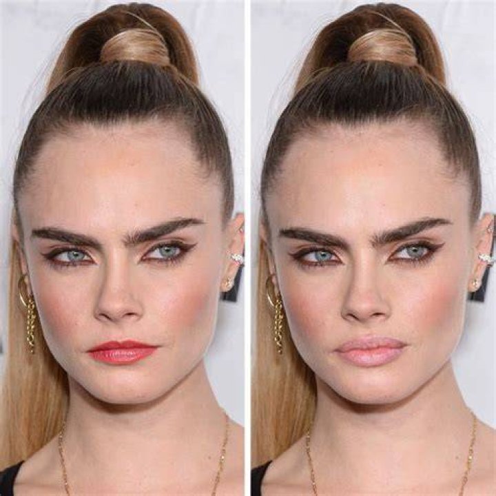 Cara Delevingne Plastic Surgery Before and After