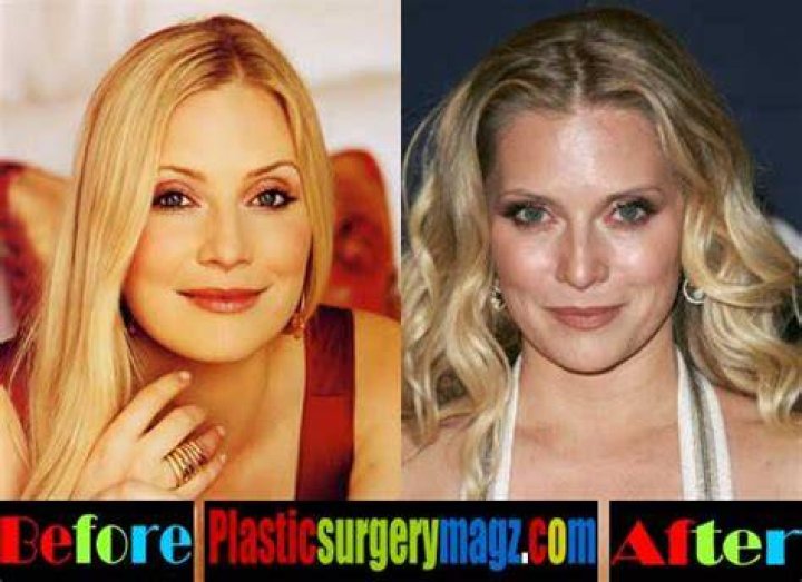 Emily Procter Breast Implants Plastic Surgery Before and After