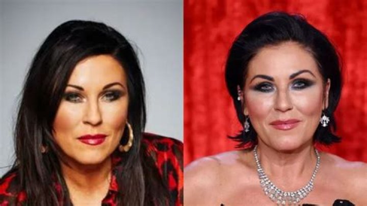 Jessie Wallace plastic surgery