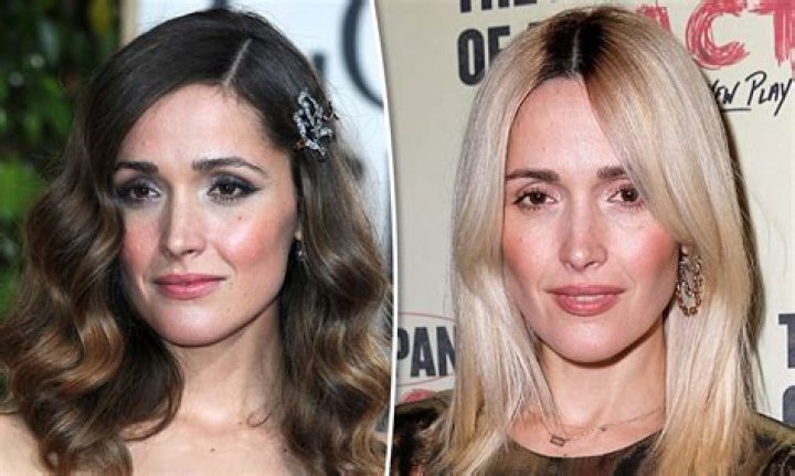 Rose Byrne Plastic Surgery Before and After